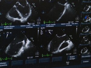 Ultrasound test in Delhi, Best diagnostic centre in Delhi, USG scan near me in Delhi, Pathology lab in Delhi for blood tests, Radiologist for ultrasound in Delhi, Color Doppler ultrasound in Delhi, Affordable blood test in Delhi, Pregnancy ultrasound clinic in Delhi, Thyroid blood test lab in Delhi, Full body checkup in Delhi diagnostic centre, Best ultrasound centre in Delhi, Pathology tests at home in Delhi, 3D/4D ultrasound services in Delhi, Liver function test (LFT) lab in Delhi, Diagnostics and pathology lab in Delhi