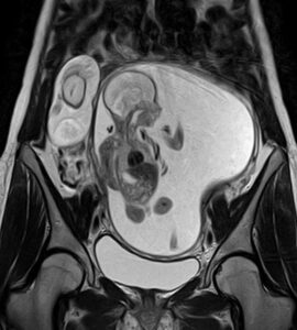 Ultrasound test in Delhi, Best diagnostic centre in Delhi, USG scan near me in Delhi, Pathology lab in Delhi for blood tests, Radiologist for ultrasound in Delhi, Color Doppler ultrasound in Delhi, Affordable blood test in Delhi, Pregnancy ultrasound clinic in Delhi, Thyroid blood test lab in Delhi, Full body checkup in Delhi diagnostic centre, Best ultrasound centre in Delhi, Pathology tests at home in Delhi, 3D/4D ultrasound services in Delhi, Liver function test (LFT) lab in Delhi, Diagnostics and pathology lab in Delhi Service area Delhi, India Rohini, Delhi, India Pitampura, Delhi, India Model Town, Delhi, India West Delhi, Delhi, India Ashok Vihar, Delhi, India Civil Lines, Delhi, India Punjabi Bagh, Delhi, India Paschim Vihar, Delhi, India Rajouri Garden, Delhi, India Gujranwala Town, Delhi, India Mukherjee Nagar, Delhi, India Karol Bagh, New Delhi, Delhi, India Shalimar Bagh, Delhi, 110088, India Hudson Lane, GTB Nagar, Delhi, 110009, India Rohini Sector 9, Sector 9, Rohini, Delhi, 110085, India West Shalimar Bagh, Shalimar Bagh, Delhi, 110088, India Rohini Sector 13, Sector 13, Rohini, Delhi, 110085, India East Shalimar Bagh, Block BH, Shalimar Bagh, Delhi, 110088, India Moti Nagar, DLE Industrial Area, Kirti Nagar, Delhi, 110015, India