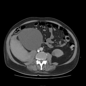 Ultrasound test in Delhi, Best diagnostic centre in Delhi, USG scan near me in Delhi, Pathology lab in Delhi for blood tests, Radiologist for ultrasound in Delhi, Color Doppler ultrasound in Delhi, Affordable blood test in Delhi, Pregnancy ultrasound clinic in Delhi, Thyroid blood test lab in Delhi, Full body checkup in Delhi diagnostic centre, Best ultrasound centre in Delhi, Pathology tests at home in Delhi, 3D/4D ultrasound services in Delhi, Liver function test (LFT) lab in Delhi, Diagnostics and pathology lab in Delhi