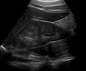 Ultrasound test in Delhi, Best diagnostic centre in Delhi, USG scan near me in Delhi, Pathology lab in Delhi for blood tests, Radiologist for ultrasound in Delhi, Color Doppler ultrasound in Delhi, Affordable blood test in Delhi, Pregnancy ultrasound clinic in Delhi, Thyroid blood test lab in Delhi, Full body checkup in Delhi diagnostic centre, Best ultrasound centre in Delhi, Pathology tests at home in Delhi, 3D/4D ultrasound services in Delhi, Liver function test (LFT) lab in Delhi, Diagnostics and pathology lab in Delhi