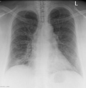 Ultrasound test in Delhi, Best diagnostic centre in Delhi, USG scan near me in Delhi, Pathology lab in Delhi for blood tests, Radiologist for ultrasound in Delhi, Color Doppler ultrasound in Delhi, Affordable blood test in Delhi, Pregnancy ultrasound clinic in Delhi, Thyroid blood test lab in Delhi, Full body checkup in Delhi diagnostic centre, Best ultrasound centre in Delhi, Pathology tests at home in Delhi, 3D/4D ultrasound services in Delhi, Liver function test (LFT) lab in Delhi, Diagnostics and pathology lab in Delhi